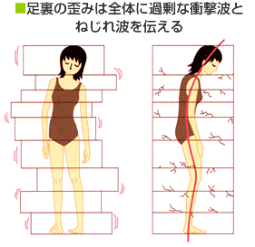 整体　体のひずみ　神戸