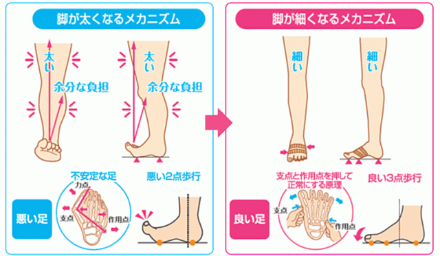 神戸　外反母趾　メカニズム