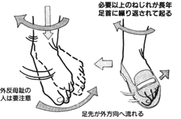 慢性的な足首の痛みでお困りの方は神戸市灘区の初村へ