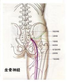 灘区　坐骨神経痛　図解