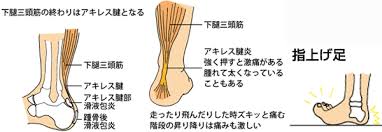 アキレス腱炎　王子公園