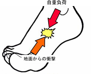 足の甲の痛み　王子公園