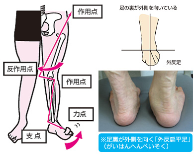 土台となる足裏から整える施術で重心を改善します